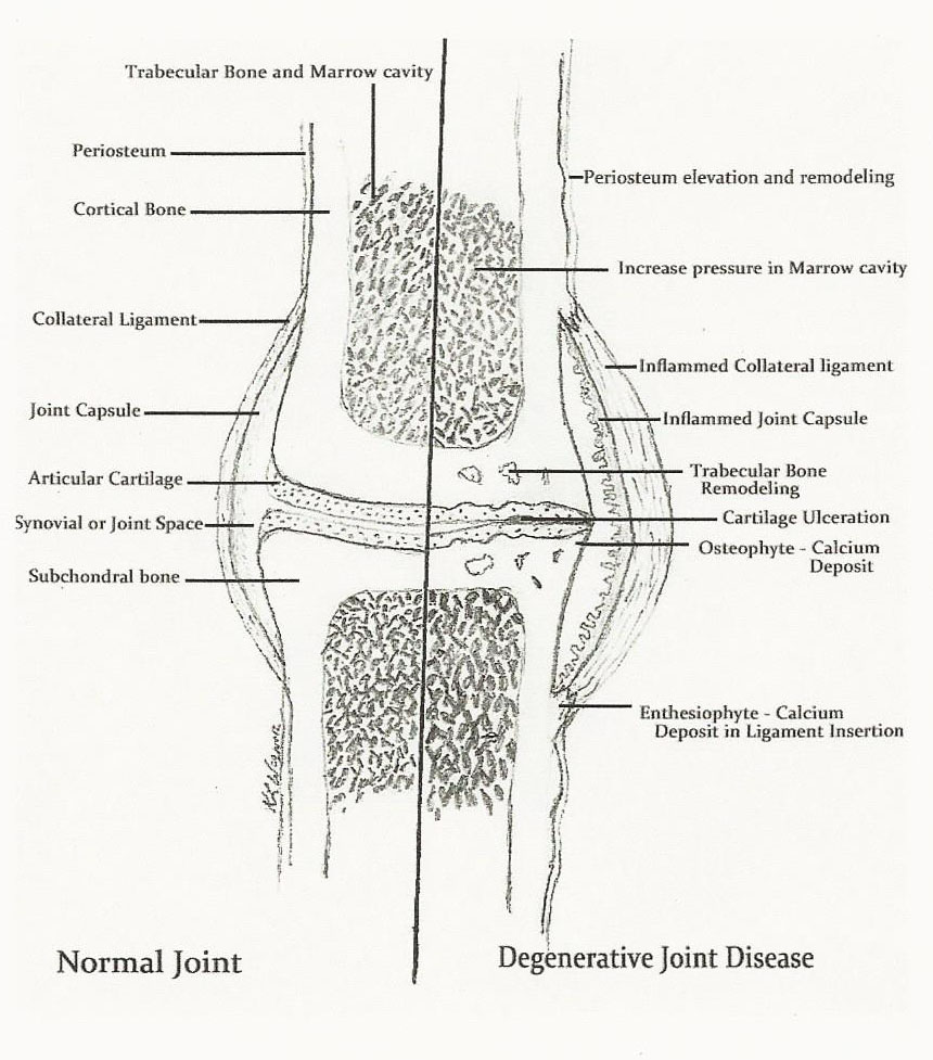 Normal Joint Degenerative Joint Disease